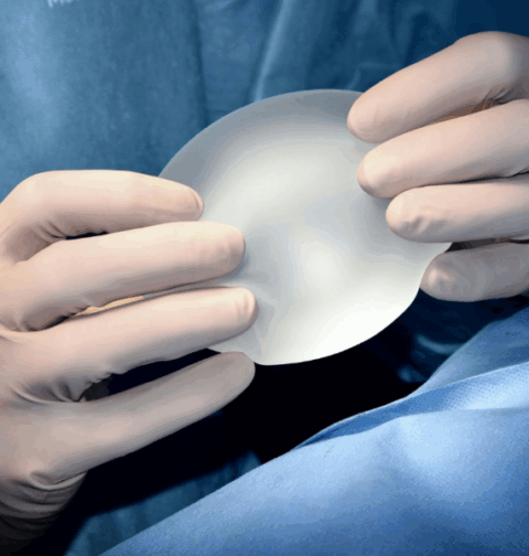Sanidad confirma un centenar de casos de un raro linfoma asociado a implantes mamarios