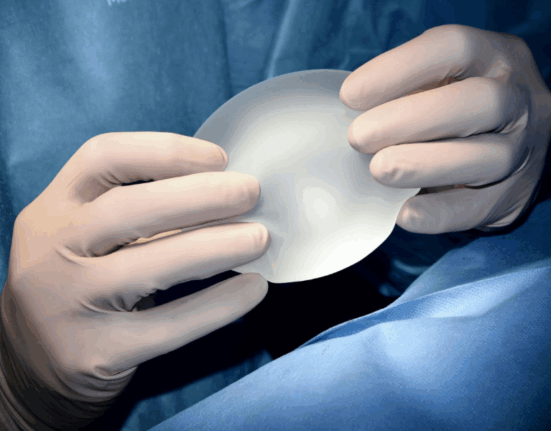 Sanidad confirma un centenar de casos de un raro linfoma asociado a implantes mamarios