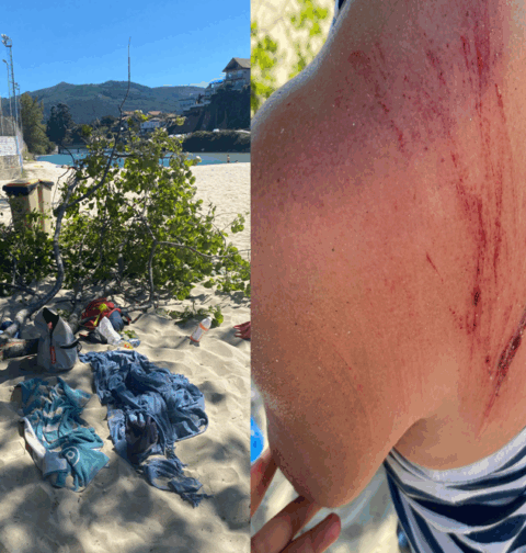 El PP de Vigo apremia a Caballero a “atender su obligación” de cuidar el arbolado después de que una rama hiriera de gravedad a una mujer en Samil